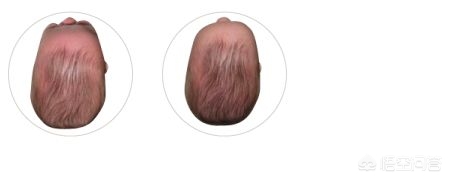 舟状头女生发型？：状头