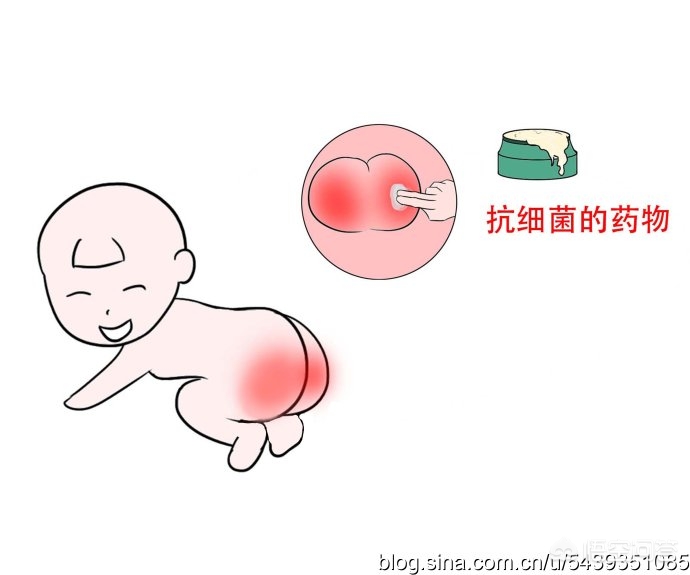 少儿保险的六大误区，少儿保险的六大误区是什么