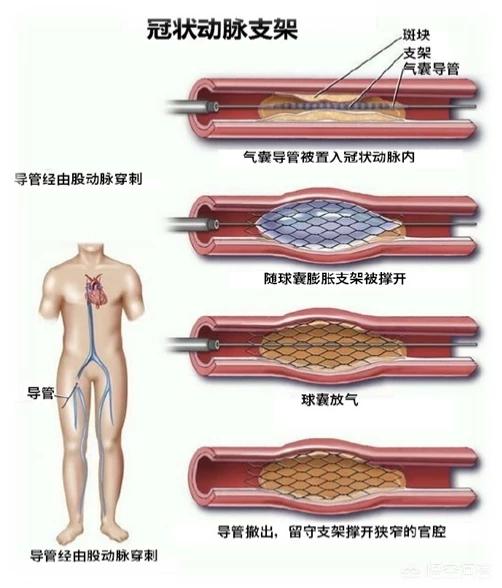 汽修保养支架，汽修保养支架图片
