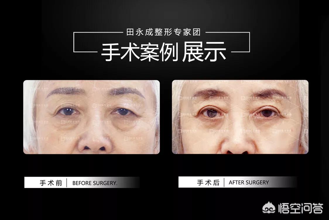 化妆技巧眼皮松弛
