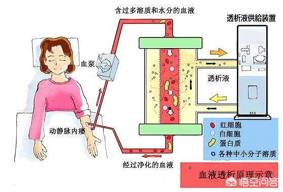 特殊床具-特殊护理床