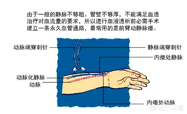 特殊床具-特殊护理床