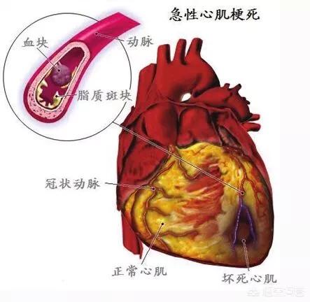 汽修保养支架，汽修保养支架图片