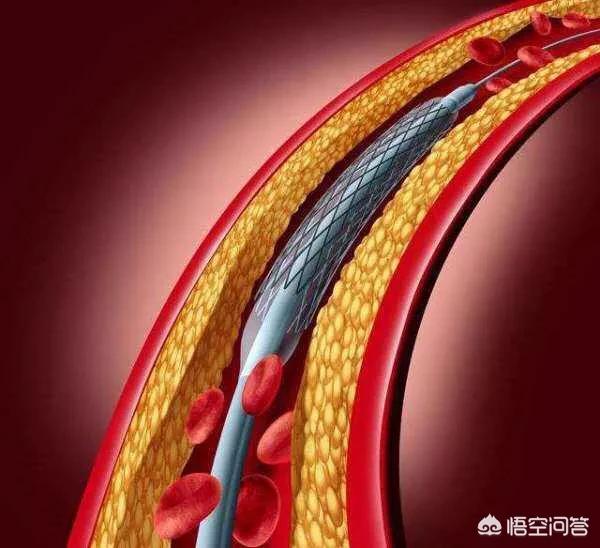 汽修保养支架，汽修保养支架图片