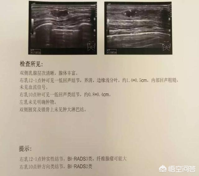 少儿超能宝胸大疾病保险，少儿超能宝重大疾病保险