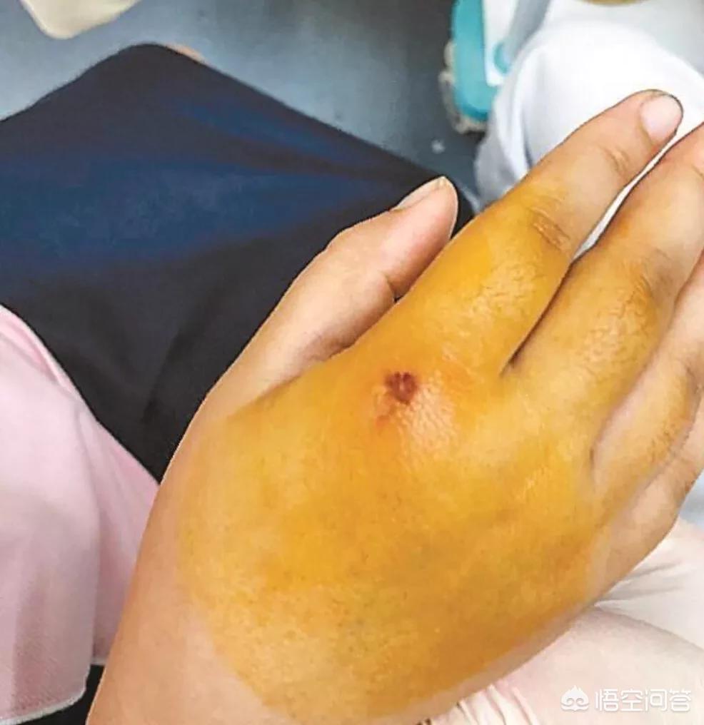 未牵绳大狗扑1岁娃（狗没牵绳被撞法律解释？）