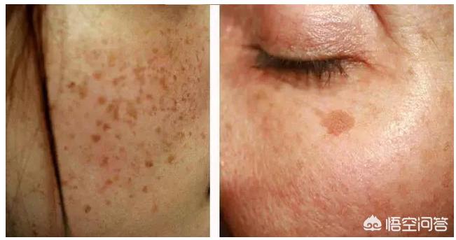 南宁市美容院怎么样营销 南宁市美容院怎么样营销