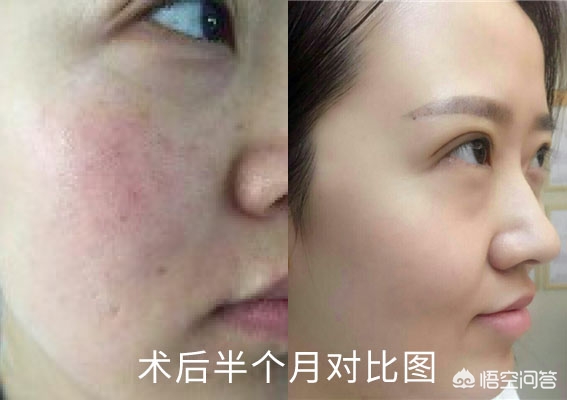 [彩光]彩光好什么意思？