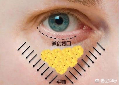 化妆泪沟小技巧
