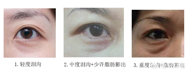 化妆泪沟小技巧
