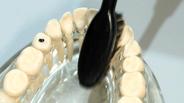 电动牙刷的好处电动牙刷的好处和坏处