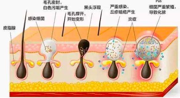 草莓拍照化妆技巧
