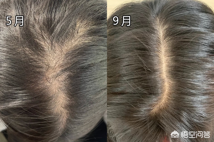 最好用的洗发水（洗发水什么牌子好用味道好闻？）