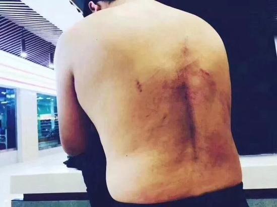 陕西人院天价停尸，记者调查被十多人用棍棒殴打关太平间，你怎么看待黑道式人民医院？：24万天价停尸费