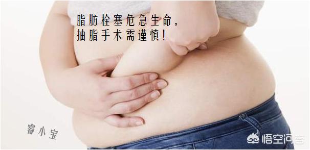 准新娘上了前男友车（如何看待上海一29岁准新娘为美抽脂，结果生命垂危？）