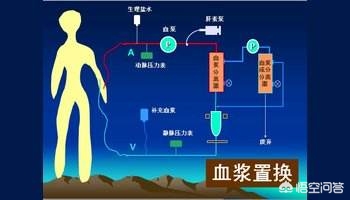 血浆置换什么意思？：富豪与儿子置换血浆