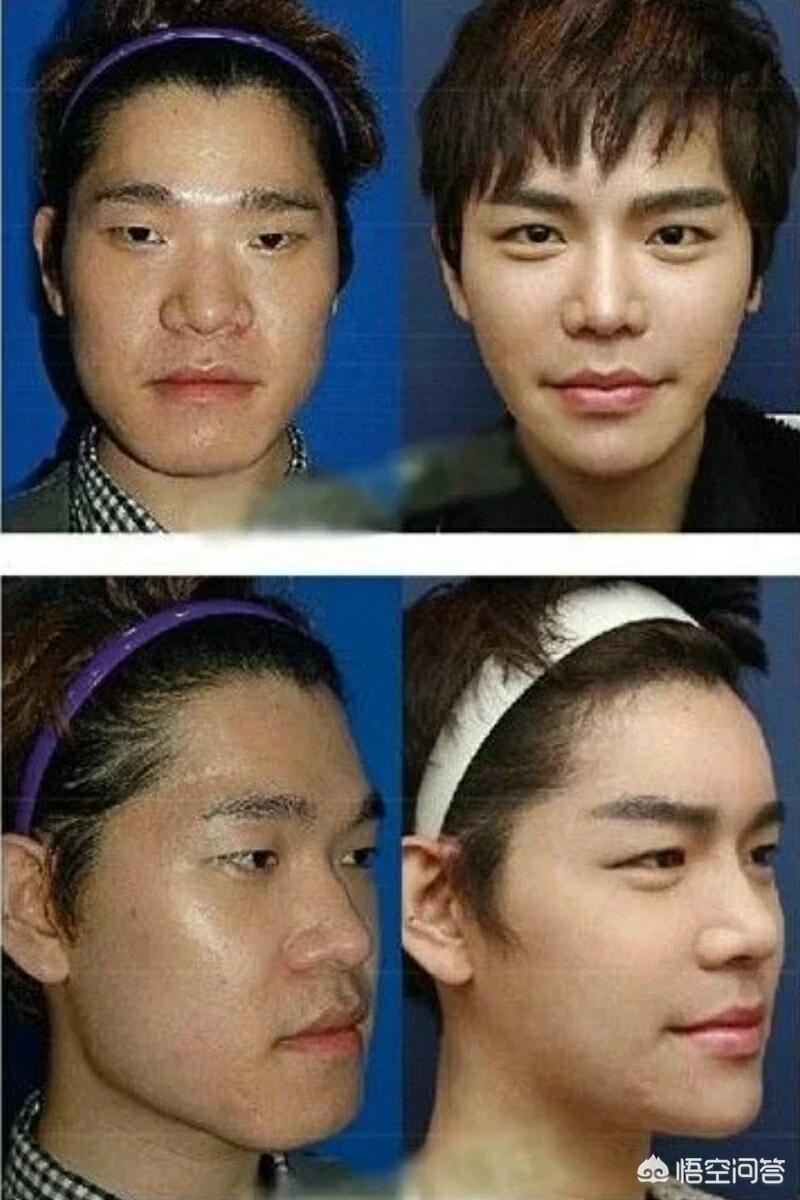 化妆小技巧韩国男孩
