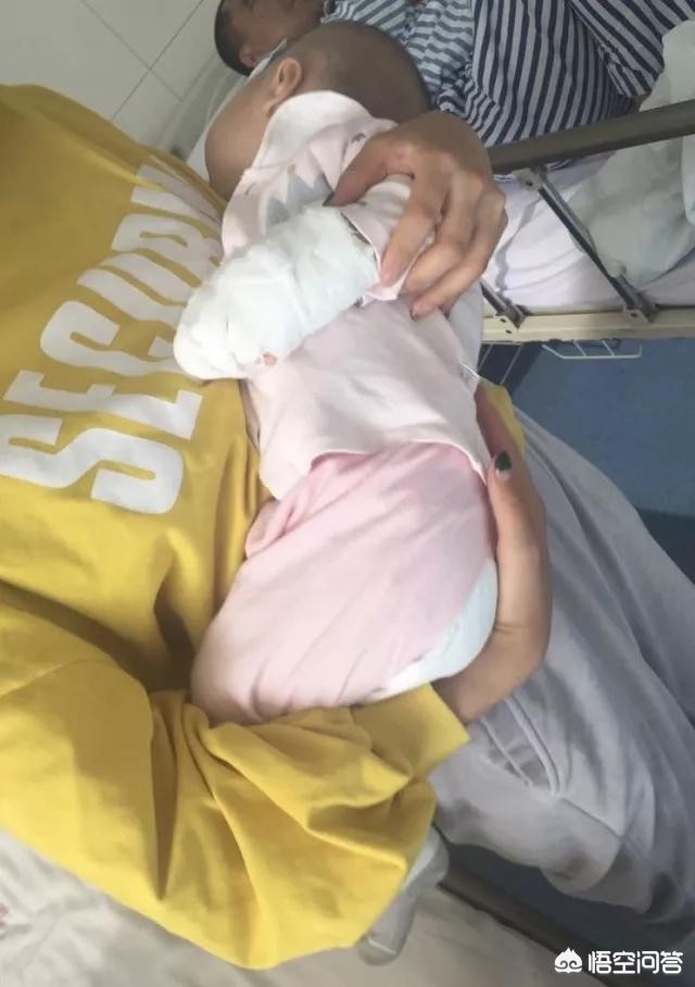 女童指尖被夹断小孩指尖被夹断