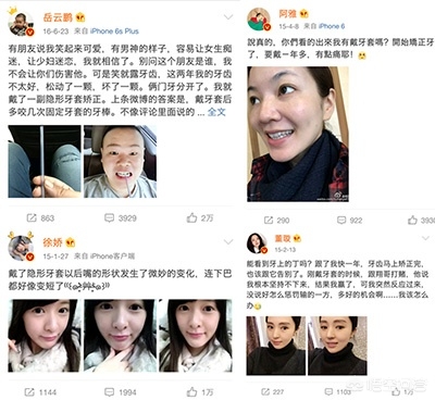 做普通的隐形牙齿矫正大概多少钱? 做普通的隐形牙齿矫正大概多少钱?