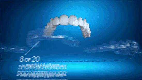 做普通的隐形牙齿矫正大概多少钱? 做普通的隐形牙齿矫正大概多少钱?