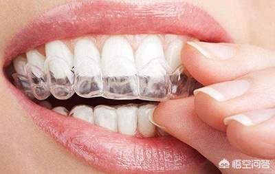 做普通的隐形牙齿矫正大概多少钱？