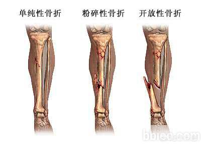 粉碎什么（粉碎什么填空？）