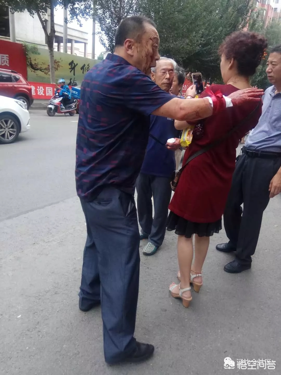 [辽宁一饭店突发火灾]沈阳十多人在一家饭店门前因为停车打起来，老人受伤，小孩被血迹吓哭，你怎么看？