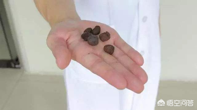 节食减肥胆上长结石