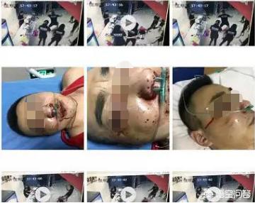 健身房教练被掌掴（成都的健身教练下手特别狠，该承担什么法律责任？）