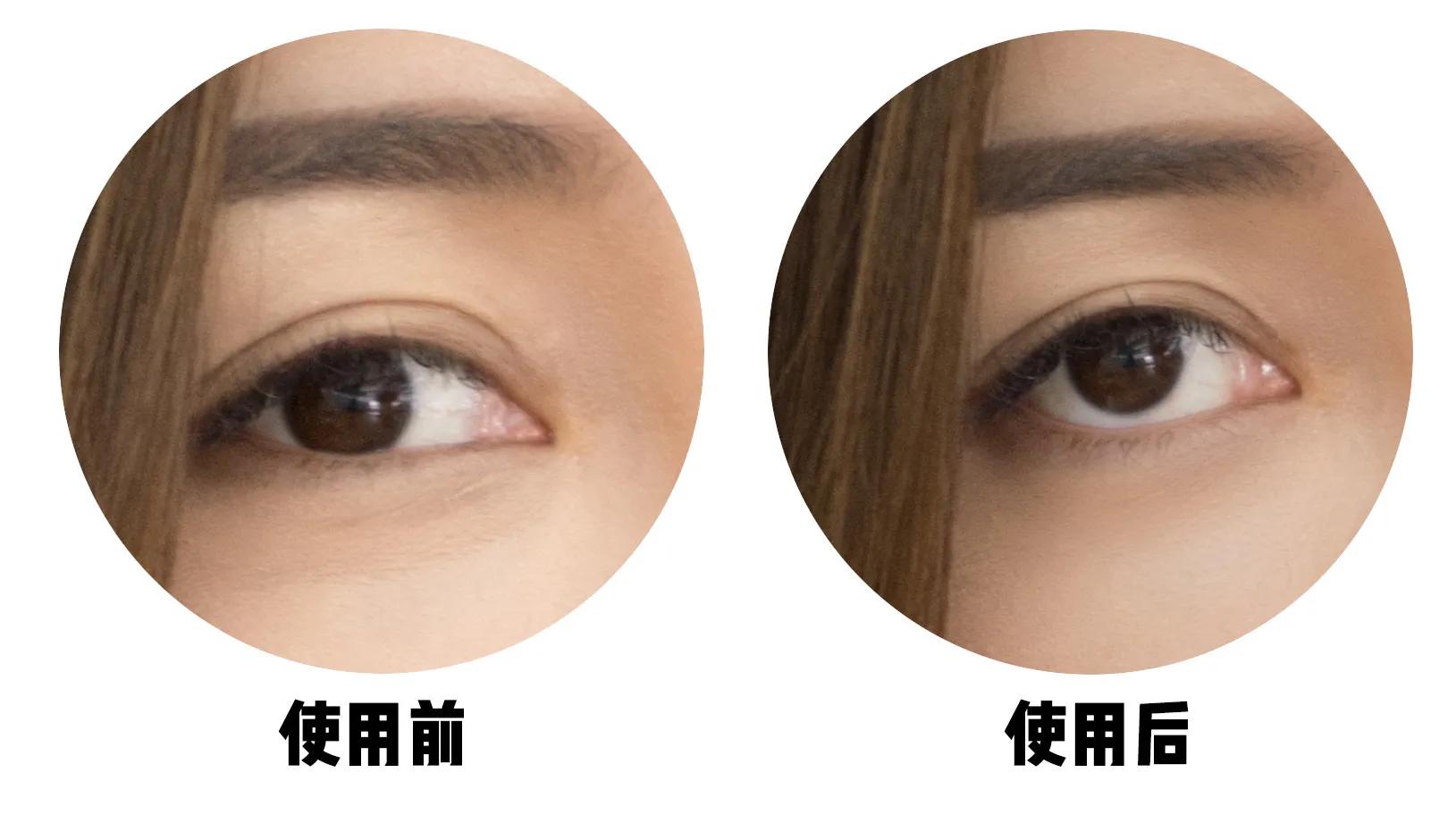 [黑眼圈眼霜]哪种眼霜去黑眼圈好？