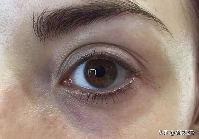 [黑眼圈眼霜]哪种眼霜去黑眼圈好？