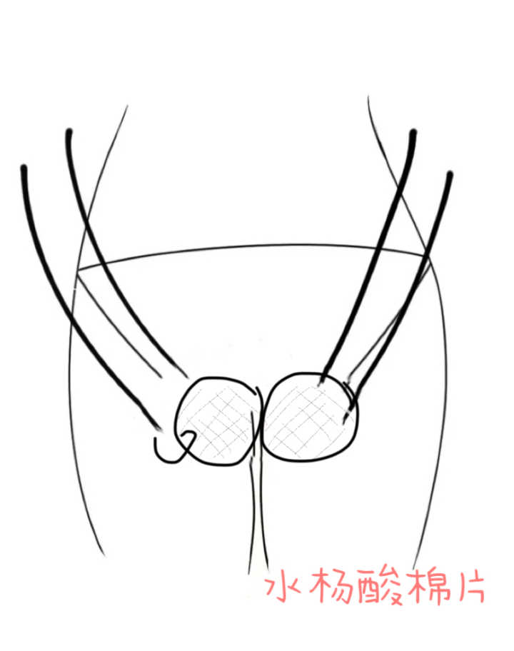 久坐要好好养屁股