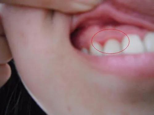 西安：艾滋病检测实验室达313个, 你怎么看？