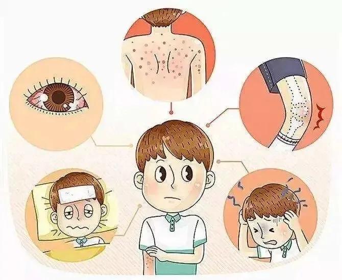 新加坡暴发史上最严重登革热疫情，登革热有多可怕？在新冠病毒防疫期间应如何预防？：一地登革热疫情上升