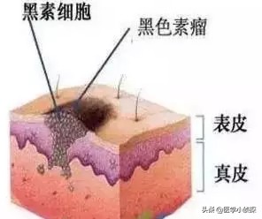 [癌症的3种信号]口干是哪种癌症的预兆？