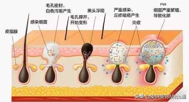 口罩不化妆技巧
