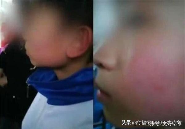 儿子喊校长绰号被扇耳光送医检查，6天后父亲从其子病房坠亡，你怎么评价？：为躲检查意外坠亡