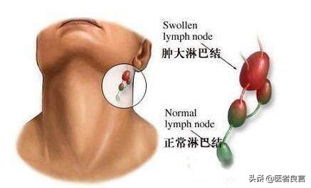 h1vh1v是艾滋病吗