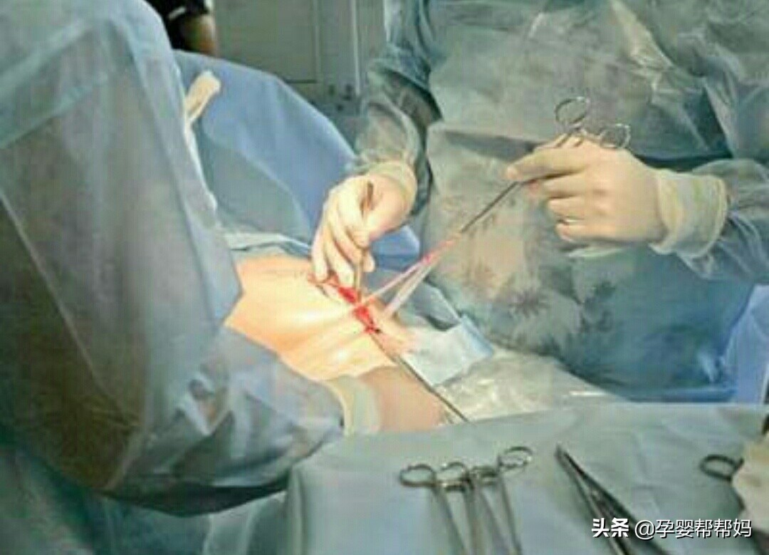 3女子带4孩多次续面