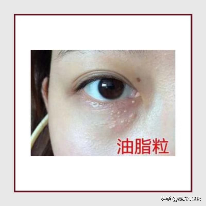眼部脂肪多化妆技巧
