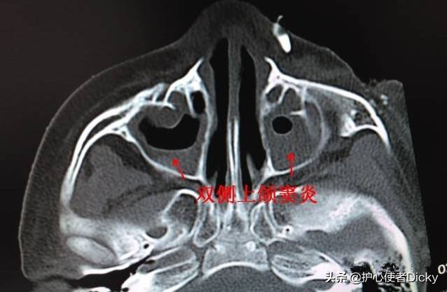 妈妈头是什么？：妈头