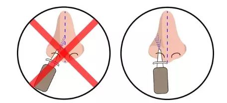 给药给药途径吸收快慢顺序 给药给药途径吸收快慢顺序