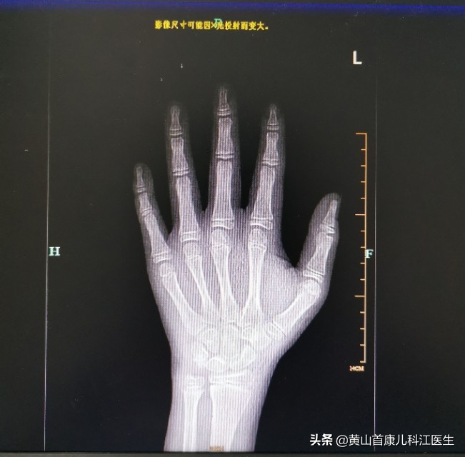 合肥市掉头发看哪个科