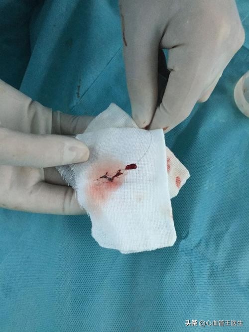 医生睡觉致患者身亡（医院检查一上午医生说没事，结果晚上得脑梗死，医生有责任吗？）