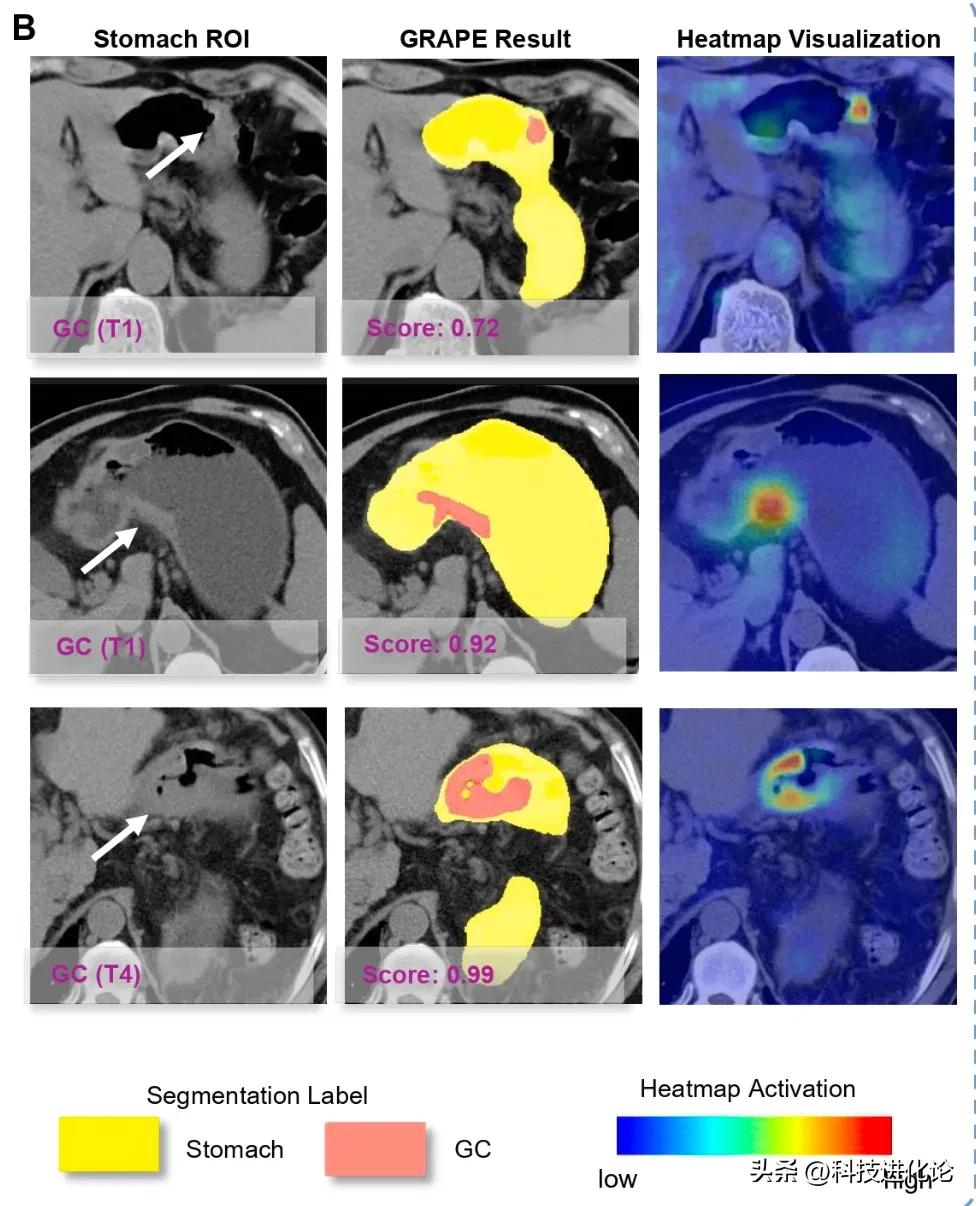 科技进化论是什么 4a0bb64e0db94c54941fa1f8a78d1fdd~tplv-shrink:976:1206.jpeg?_iz=97245&bid=15&from=post.profile_all&gid=1837886588502020&lk3s=06827d14&x-expires=1763856000&x-signature=h1OSE8liyjeG0JIV%2B%2BKgOfRglMQ%3D