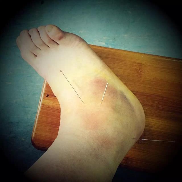 首百：Vibram HK100 伤残“兮兮 加油”抱得最后一个银人归