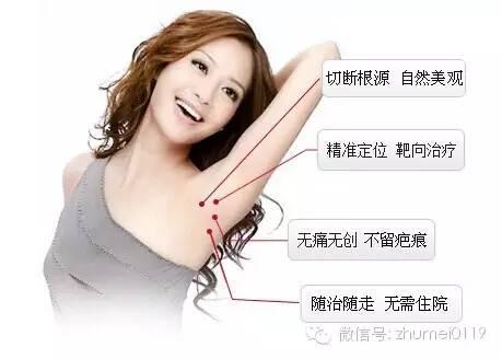 莫要让腋臭成为婚姻的绊脚石！