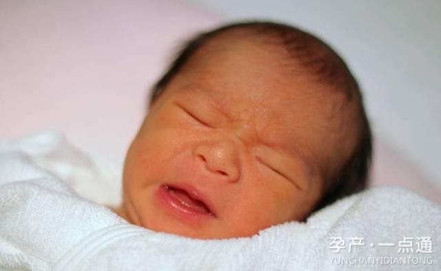 台州一婴儿出生不久就全身换血，婴儿的病理性黄疸妈妈要警惕