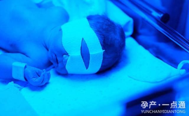 台州一婴儿出生不久就全身换血，婴儿的病理性黄疸妈妈要警惕