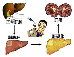 “江湖”药方抗 肝病，希望对你有帮助。不看可惜。